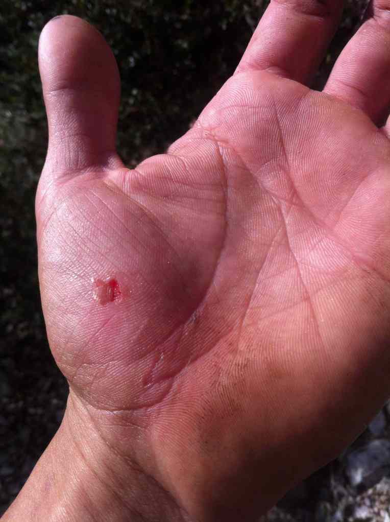 Cut on the hand doesn't matter